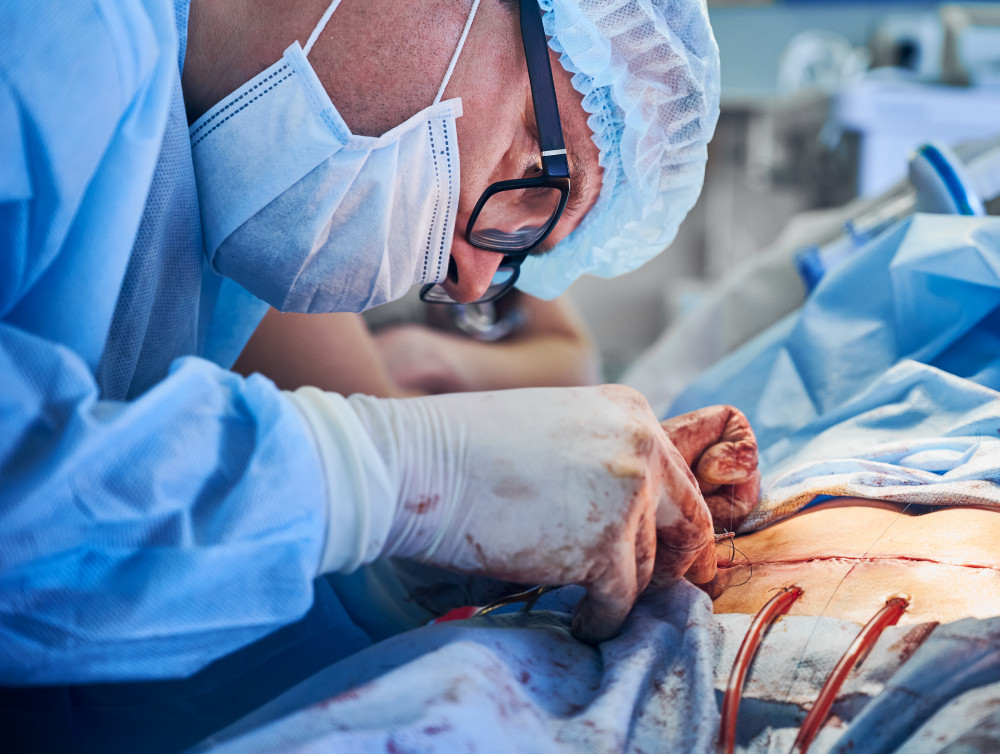 Abdominoplastie : quand la faire pour retrouver un ventre plat ?
